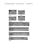 CONNECTIVE TISSUE MONITORING, COMPOSITIONS FOR CONNECTIVE TISSUE TREATMENT     AND METHODS FOR TREATING CONNECTIVE TISSUE diagram and image