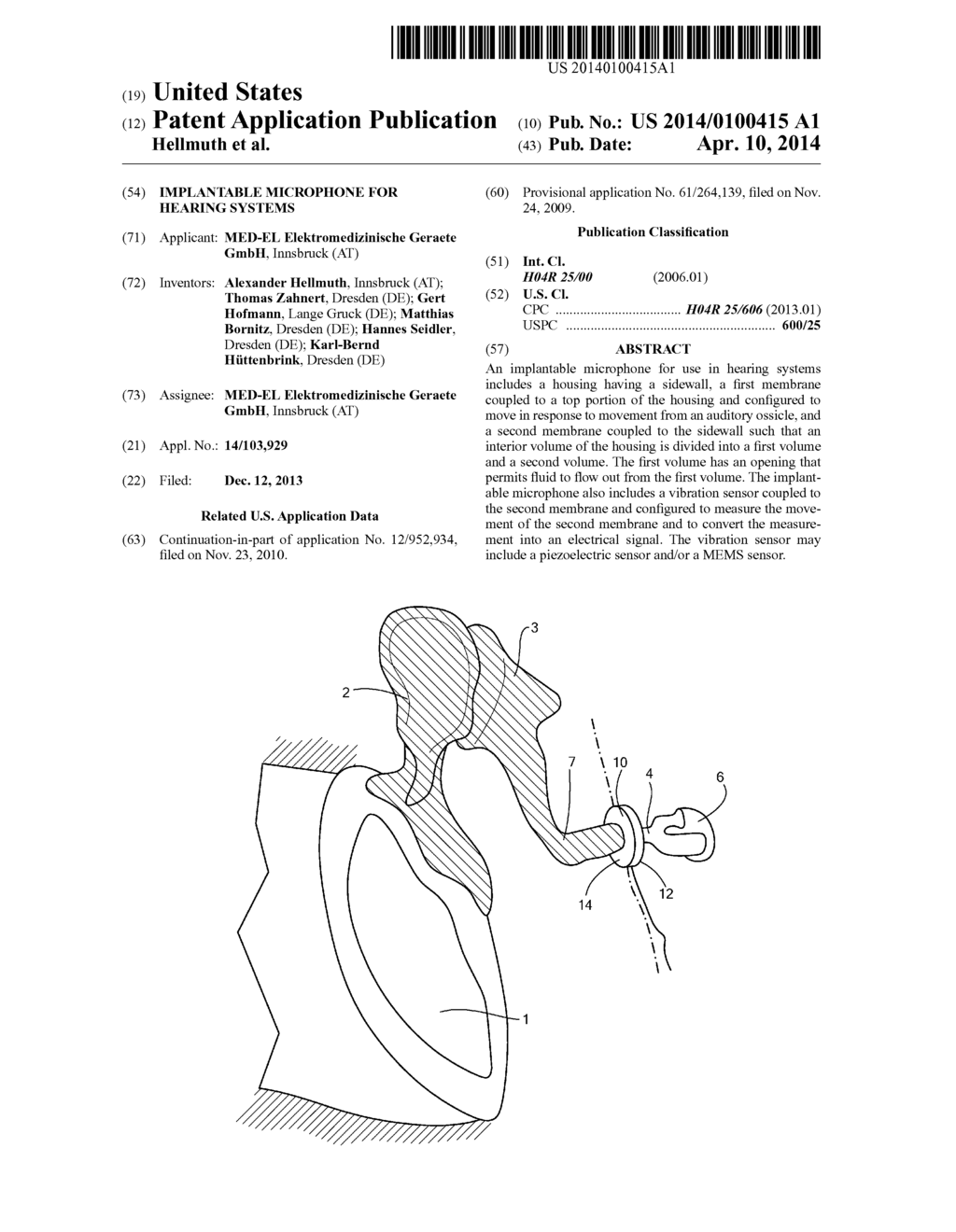 IMPLANTABLE MICROPHONE FOR HEARING SYSTEMS - diagram, schematic, and image 01