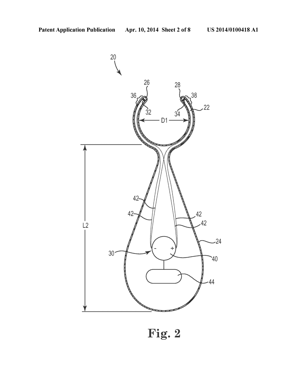 MAGNETIC INCONTINENCE TREATMENT DEVICE - diagram, schematic, and image 03