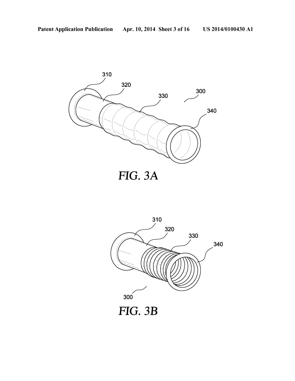 APPLICATOR, ASSEMBLY, AND METHOD FOR CONNECTING AN INLET CONDUIT TO A     HOLLOW ORGAN - diagram, schematic, and image 04