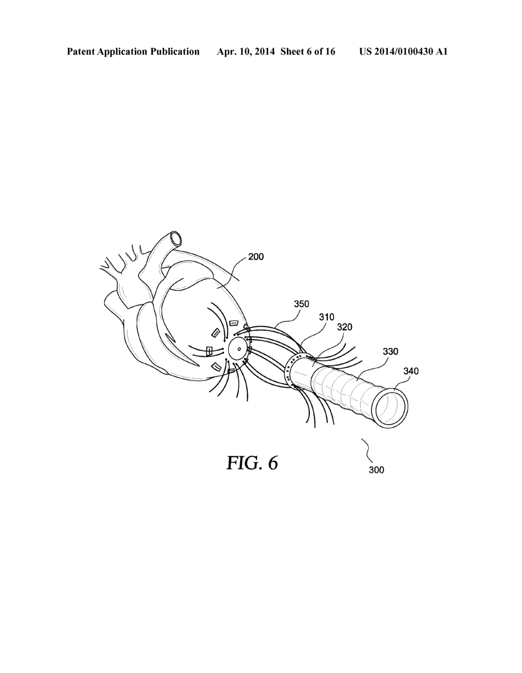 APPLICATOR, ASSEMBLY, AND METHOD FOR CONNECTING AN INLET CONDUIT TO A     HOLLOW ORGAN - diagram, schematic, and image 07