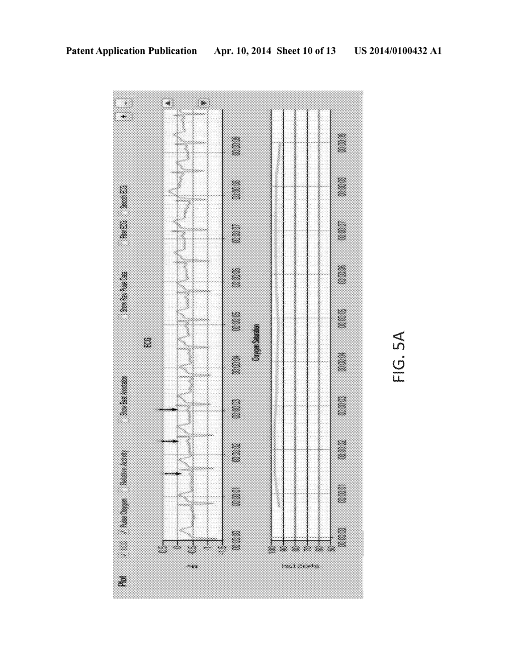 Wearable Cardiac Monitor - diagram, schematic, and image 11