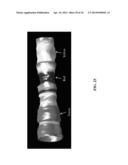 SYSTEMS FOR INDICATING PARAMETERS IN AN IMAGING DATA SET AND METHODS OF     USE diagram and image