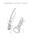 Scanned Laser Vein Contrast Enhancer diagram and image