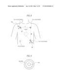 ELECTROCARDIOGRAM ANALYZER AND ELECTRODE SET diagram and image