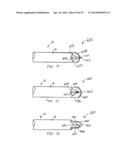 NEEDLE TIP FOR BIOPSY DEVICE diagram and image