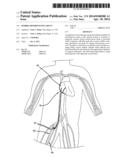 HYBRID ARTERIOVENOUS SHUNT diagram and image