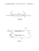 METHODS AND APPARATUS FOR ANCHORING WITHIN THE GASTROINTESTINAL TRACT diagram and image