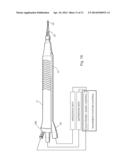 OPHTHALMIC SURGICAL INSTRUMENT WITH PRE-SET TIP-TO-SHELL ORIENTATION diagram and image