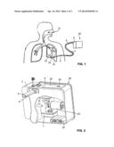 ADAPTIVE ALGORITHM FOR THORACIC DRAINAGE THERAPY diagram and image