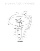 INFUSION SET WITH SAFETY DEVICE diagram and image