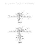 INFUSION SET WITH SAFETY DEVICE diagram and image