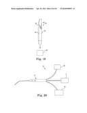 ELECTROSURGICAL DEVICE FOR CUTTING AND REMOVING TISSUE diagram and image