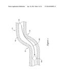 MEDICAL DEVICE HAVING AN ELECTRO-MAGNETIC DEVICE TIP AND RELATED METHOD OF     USE diagram and image