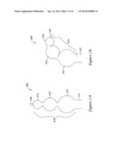 MEDICAL DEVICE HAVING AN ELECTRO-MAGNETIC DEVICE TIP AND RELATED METHOD OF     USE diagram and image