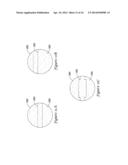 MEDICAL DEVICE HAVING AN ELECTRO-MAGNETIC DEVICE TIP AND RELATED METHOD OF     USE diagram and image