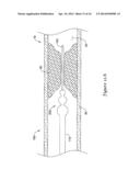 MEDICAL DEVICE HAVING AN ELECTRO-MAGNETIC DEVICE TIP AND RELATED METHOD OF     USE diagram and image