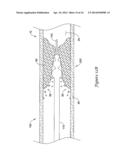 MEDICAL DEVICE HAVING AN ELECTRO-MAGNETIC DEVICE TIP AND RELATED METHOD OF     USE diagram and image