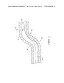 MEDICAL DEVICE HAVING AN ELECTRO-MAGNETIC DEVICE TIP AND RELATED METHOD OF     USE diagram and image