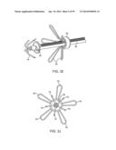 SYSTEM AND METHOD FOR TRANSAPICAL ACCESS AND CLOSURE diagram and image