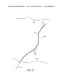 SYSTEM AND METHOD FOR TRANSAPICAL ACCESS AND CLOSURE diagram and image