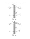 SYSTEM AND METHOD FOR TRANSAPICAL ACCESS AND CLOSURE diagram and image