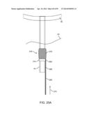 SYSTEM AND METHOD FOR TRANSAPICAL ACCESS AND CLOSURE diagram and image