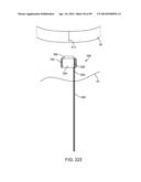 SYSTEM AND METHOD FOR TRANSAPICAL ACCESS AND CLOSURE diagram and image