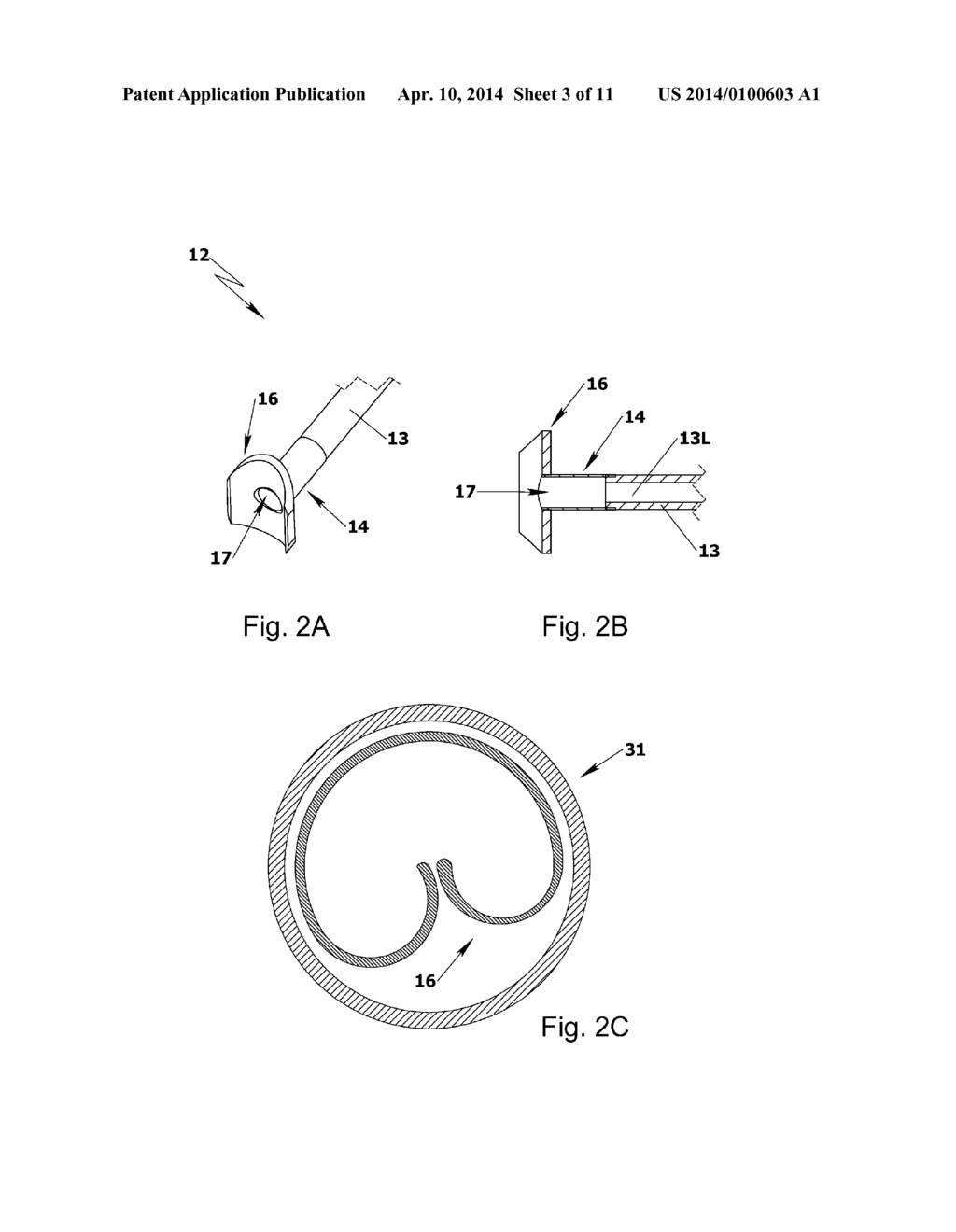 DEVICE FOR SEALING PERFORATIONS AND SUSTAINING FLOW - diagram, schematic, and image 04