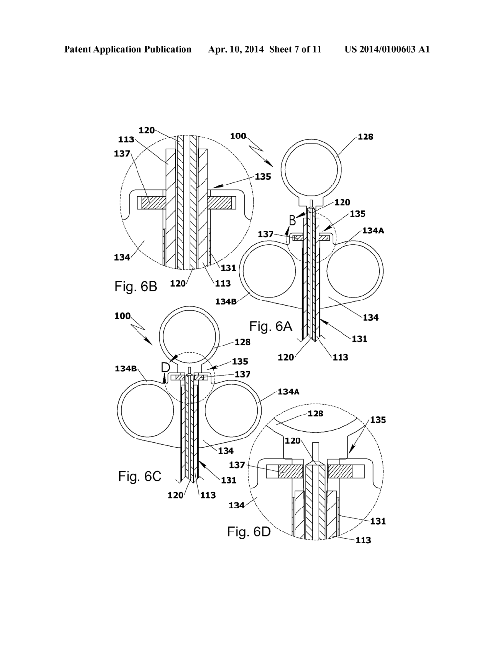 DEVICE FOR SEALING PERFORATIONS AND SUSTAINING FLOW - diagram, schematic, and image 08