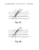 APPARATUS AND METHODS FOR SEALING A VASCULAR PUNCTURE diagram and image