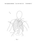 APPARATUS AND METHOD FOR ALIGNING A SPINE diagram and image