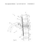 APPARATUS AND METHOD FOR ALIGNING A SPINE diagram and image