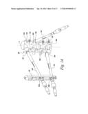 DEROTATION INSTRUMENT WITH REDUCTION FUNCTIONALITY diagram and image