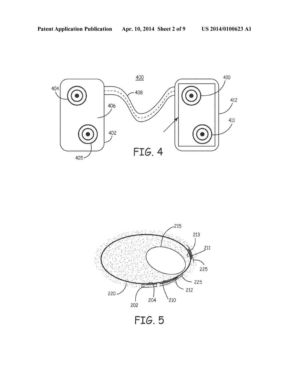 METHOD AND APPARATUS FOR ARRHYTHMIA DETECTION IN A MEDICAL DEVICE - diagram, schematic, and image 03