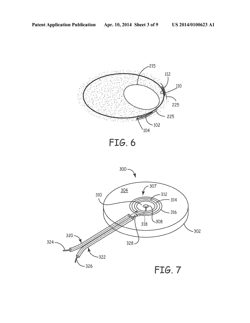 METHOD AND APPARATUS FOR ARRHYTHMIA DETECTION IN A MEDICAL DEVICE - diagram, schematic, and image 04