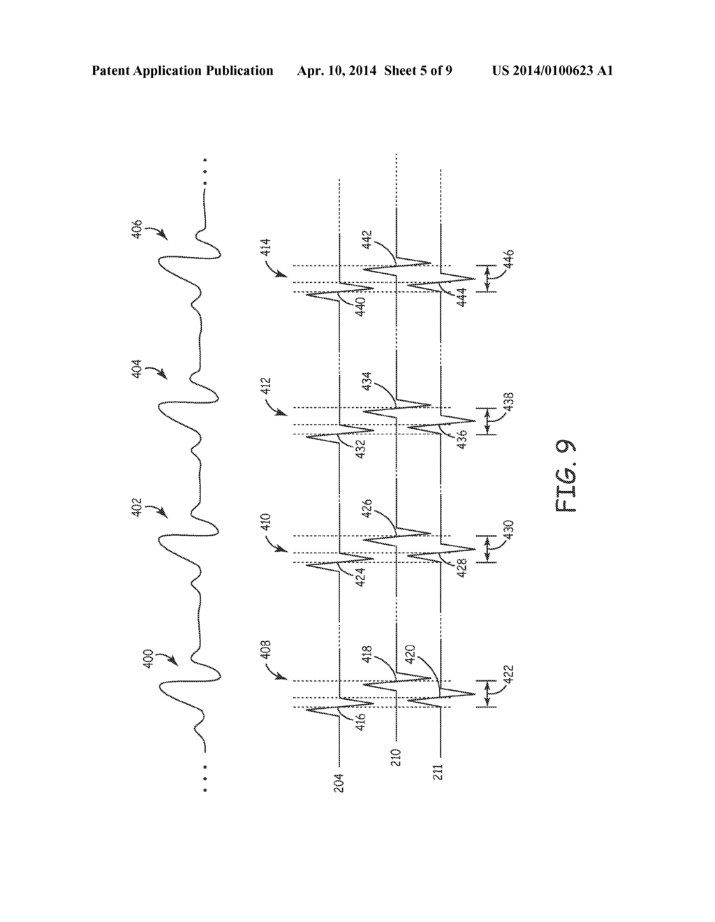 METHOD AND APPARATUS FOR ARRHYTHMIA DETECTION IN A MEDICAL DEVICE - diagram, schematic, and image 06