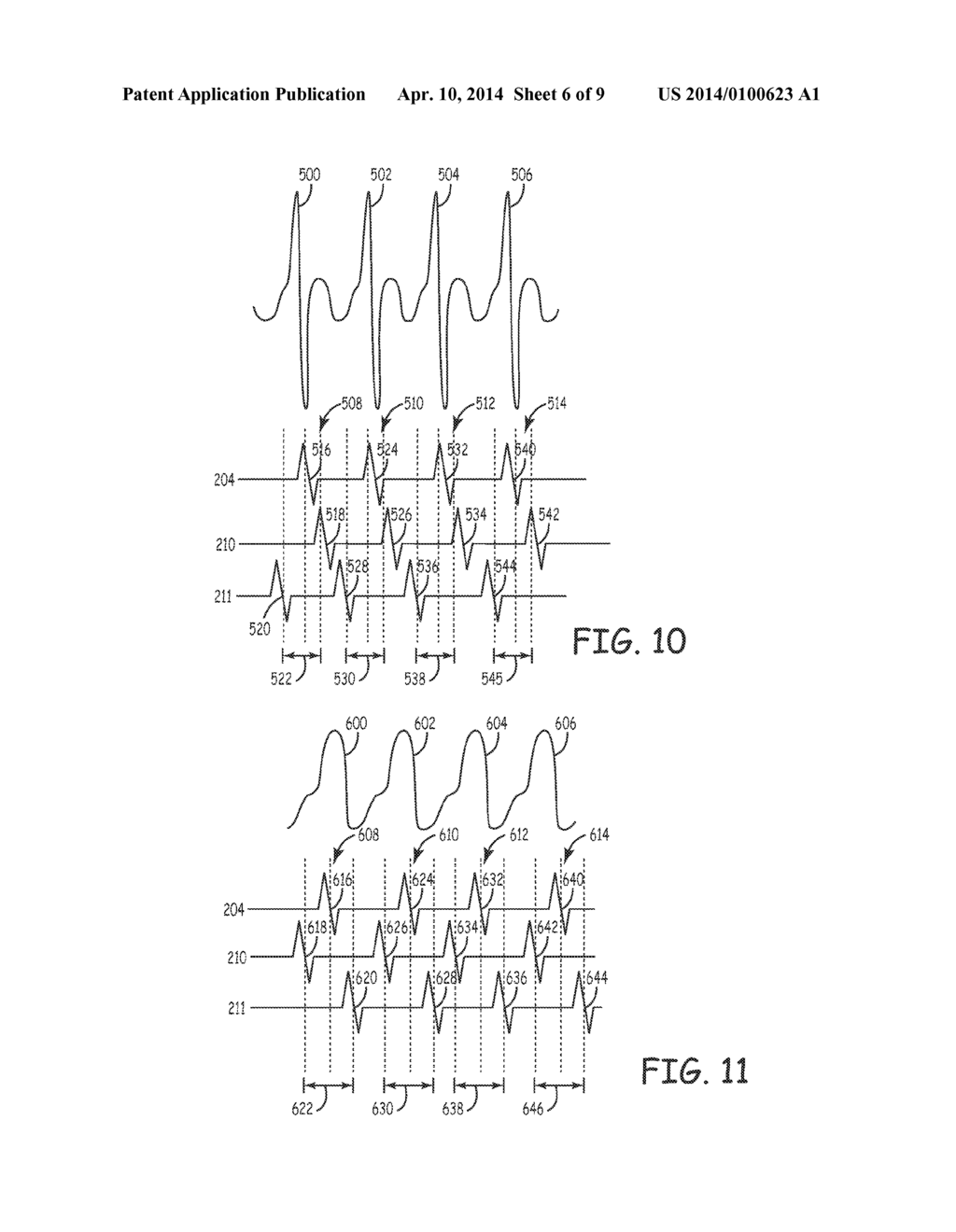 METHOD AND APPARATUS FOR ARRHYTHMIA DETECTION IN A MEDICAL DEVICE - diagram, schematic, and image 07