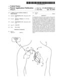 CARDIAC PACING DURING MEDICAL PROCEDURES diagram and image