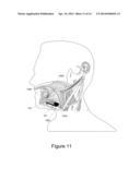 Antenna Providing Variable Communication With An Implant diagram and image