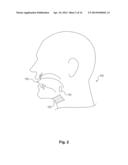 SYSTEM AND METHOD FOR NERVE MODULATION USING NONCONTACTING ELECTRODES diagram and image