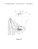 SYSTEM AND METHOD FOR NERVE MODULATION USING NONCONTACTING ELECTRODES diagram and image