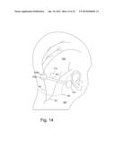 SYSTEM AND METHOD FOR NERVE MODULATION USING NONCONTACTING ELECTRODES diagram and image