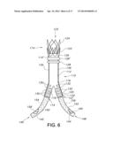 ENDOVASCULAR GRAFT FOR ANEURYSMS INVOLVING MAJOR BRANCH VESSELS diagram and image