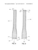 ENDOVASCULAR GRAFT FOR ANEURYSMS INVOLVING MAJOR BRANCH VESSELS diagram and image