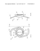 REMOTE MULTIFOCAL TO MONOFOCAL OPTIC CONVERSION diagram and image