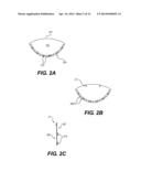 SURGICAL TEMPLATE AND DELIVERY DEVICE diagram and image