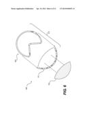 SURGICAL TEMPLATE AND DELIVERY DEVICE diagram and image