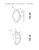 SURGICAL TEMPLATE AND DELIVERY DEVICE diagram and image