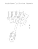 METHOD AND APPARATUS FOR MINIMALLY INVASIVE INSERTION OF INTERVERTEBRAL     IMPLANTS diagram and image